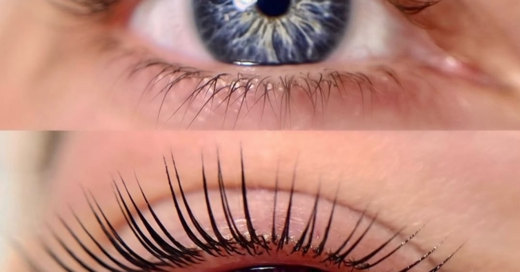 Antes e depois
